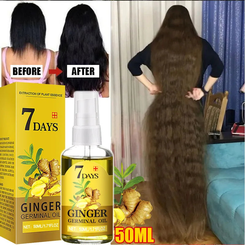 Fast Hair Growth Men Women Ginger Growth Hair Oil Treatment Anti Hair Loss Scalp Treatment Serum Products Beauty Health