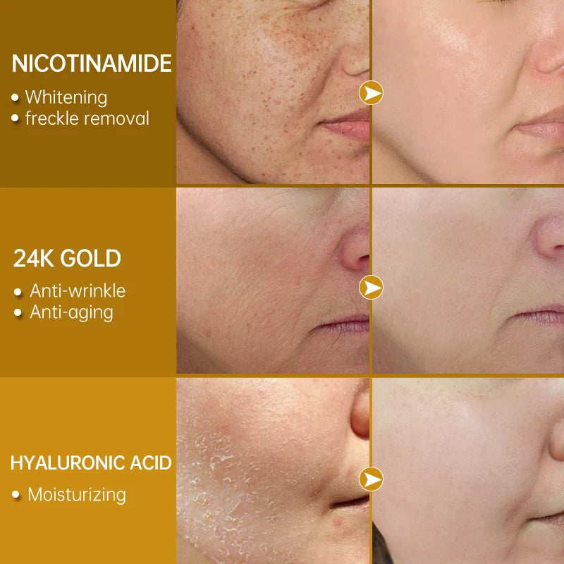 Niacinamide Serum Hyaluronic Acid for Face Dark Spot Remover 24K Gold Serum Whitening Moisturizing Facial Skin Care